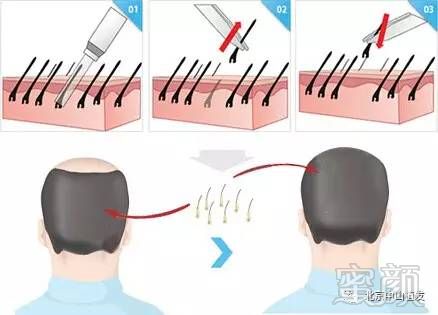 https://img.miyanlife.com/mnt/timg/170803/1532221D7-1.jpg