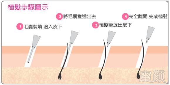 https://img.miyanlife.com/mnt/timg/170803/19101H315-2.jpg