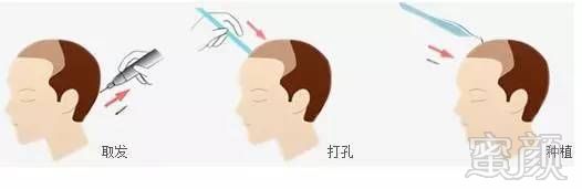 https://img.miyanlife.com/mnt/timg/170803/19101L249-1.jpg