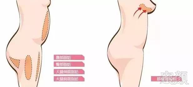 https://img.miyanlife.com/mnt/timg/170803/1QF215V-3.jpg