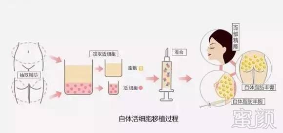 https://img.miyanlife.com/mnt/timg/170803/1QF35151-4.jpg