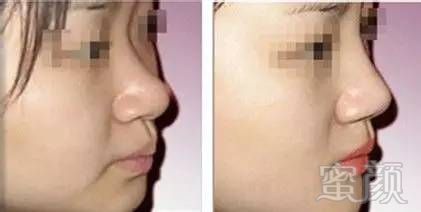 https://img.miyanlife.com/mnt/timg/170803/1T1432a4-1.jpg