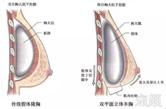 案例图片