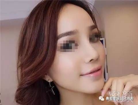 https://img.miyanlife.com/mnt/timg/170803/21010W0M-4.jpg