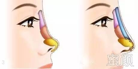 https://img.miyanlife.com/mnt/timg/170804/1349102004-2.jpg