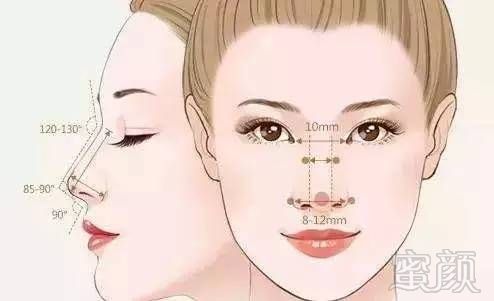https://img.miyanlife.com/mnt/timg/170804/1349104C6-1.jpg
