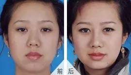 https://img.miyanlife.com/mnt/timg/170804/1349105J7-3.jpg