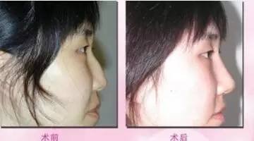 https://img.miyanlife.com/mnt/timg/170804/13491111D-6.jpg
