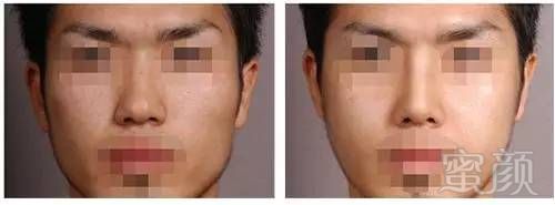 https://img.miyanlife.com/mnt/timg/170804/134911N93-7.jpg