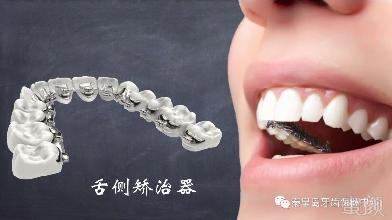 https://img.miyanlife.com/mnt/timg/170804/1351012359-2.jpg