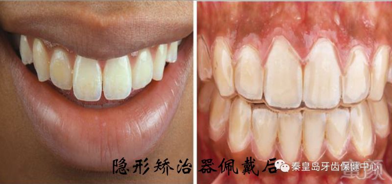 https://img.miyanlife.com/mnt/timg/170804/13510315H-4.jpg