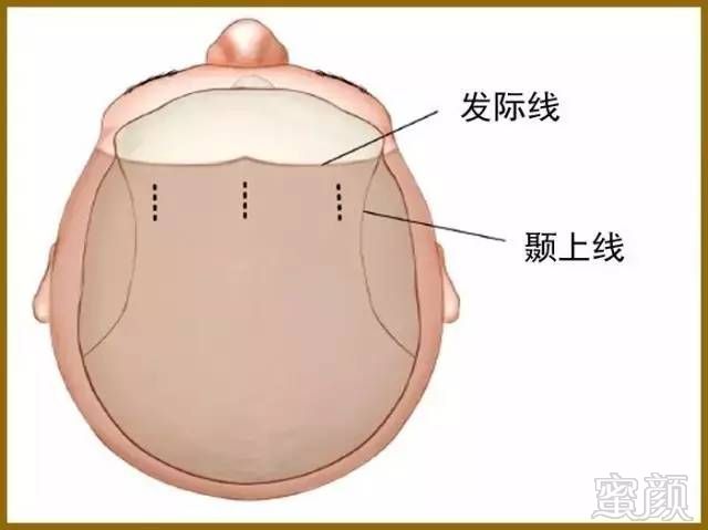 案例图片