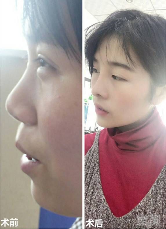 https://img.miyanlife.com/mnt/timg/170805/2205394344-11.jpg