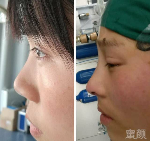 https://img.miyanlife.com/mnt/timg/170805/22053J926-4.jpg