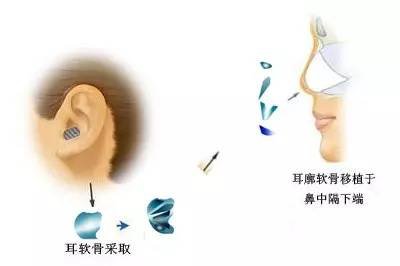 https://img.miyanlife.com/mnt/timg/170805/22092255c-2.jpg