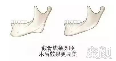 案例图片