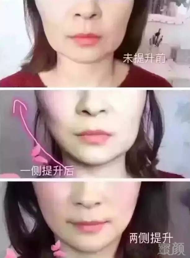 案例图片