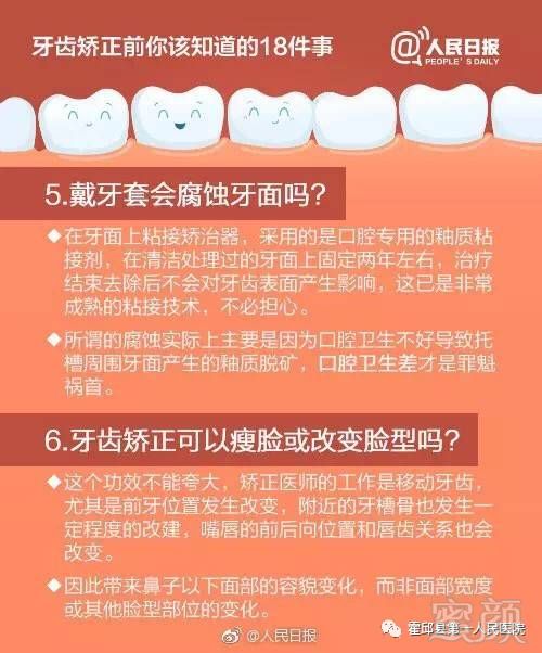 https://img.miyanlife.com/mnt/timg/170808/13443MV5-2.jpg