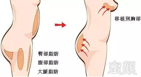 https://img.miyanlife.com/mnt/timg/170808/14002GJ3-0.jpg