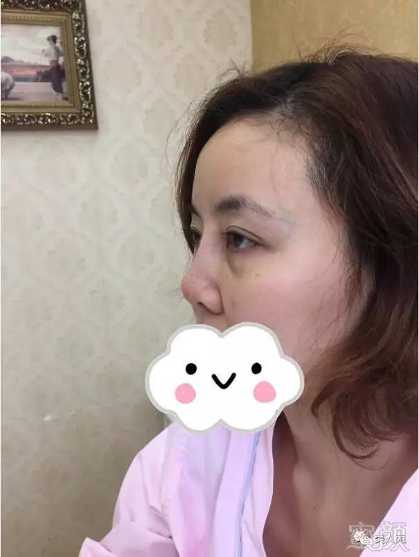 https://img.miyanlife.com/mnt/timg/170808/1412562247-0.jpg