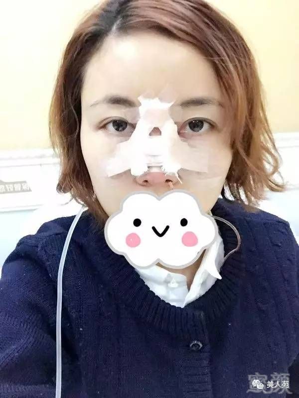 https://img.miyanlife.com/mnt/timg/170808/14125C356-2.jpg