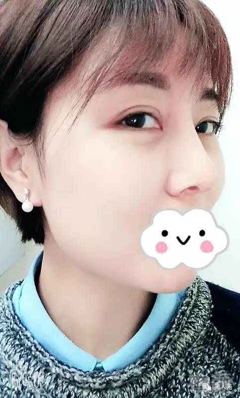 https://img.miyanlife.com/mnt/timg/170808/1413001124-10.jpg