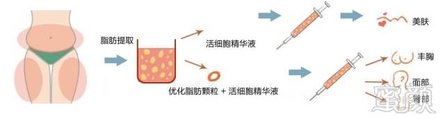 https://img.miyanlife.com/mnt/timg/170808/1426145115-5.jpg