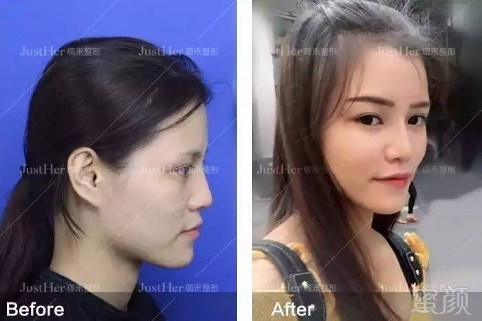 https://img.miyanlife.com/mnt/timg/170808/142614J52-8.jpg