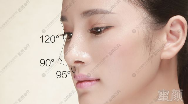 https://img.miyanlife.com/mnt/timg/170808/1454534954-3.jpg