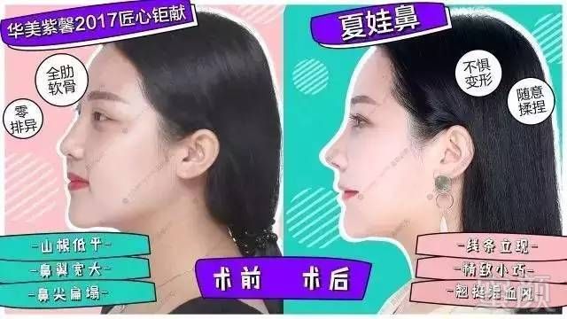 https://img.miyanlife.com/mnt/timg/170808/145454KM-6.jpg