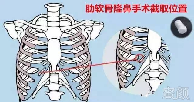 https://img.miyanlife.com/mnt/timg/170808/1454555031-8.jpg
