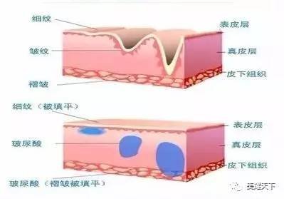 案例图片