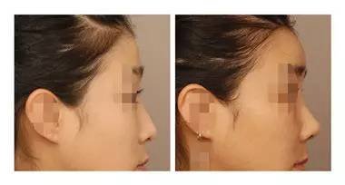 https://img.miyanlife.com/mnt/timg/170809/1444013X3-9.jpg