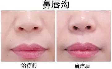https://img.miyanlife.com/mnt/timg/170809/1444023060-12.jpg