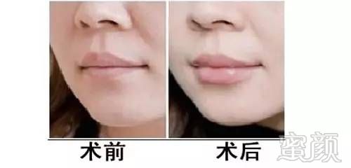 https://img.miyanlife.com/mnt/timg/170809/1444026153-13.jpg