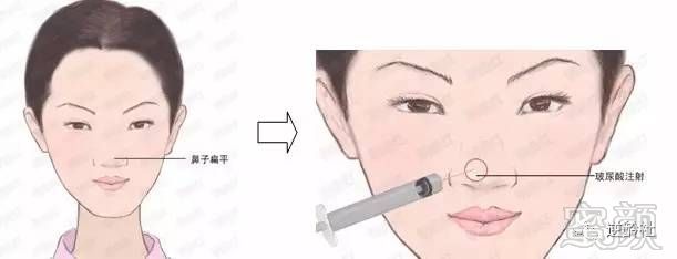https://img.miyanlife.com/mnt/timg/170810/1420432000-15.jpg