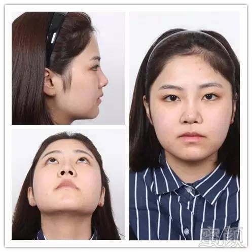 https://img.miyanlife.com/mnt/timg/170811/13351410A-0.jpg