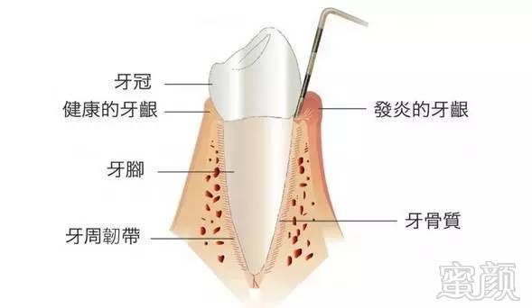 案例图片