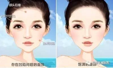 https://img.miyanlife.com/mnt/timg/170812/1912502161-0.jpg