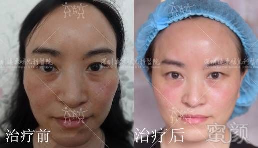 https://img.miyanlife.com/mnt/timg/170820/1GSJV3-7.jpg