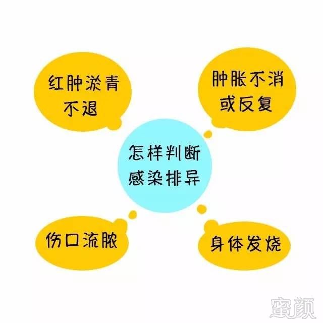 https://img.miyanlife.com/mnt/timg/170822/145I14T4-8.jpg