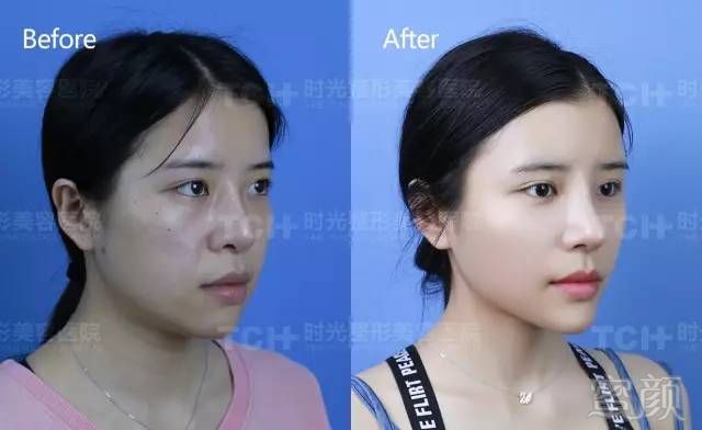 https://img.miyanlife.com/mnt/timg/170823/1526432601-7.jpg