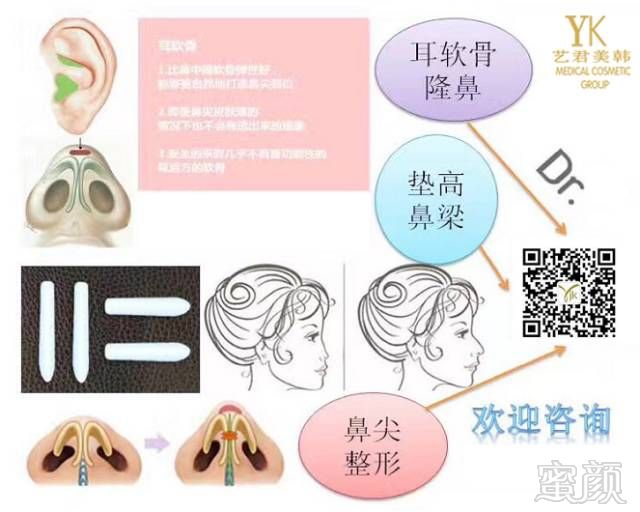 https://img.miyanlife.com/mnt/timg/170824/15064R556-0.jpg