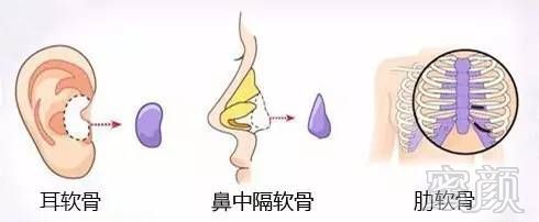 https://img.miyanlife.com/mnt/timg/170825/1350523421-4.jpg