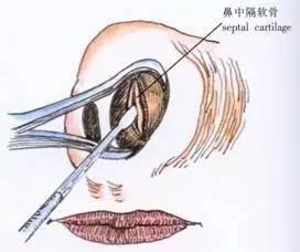 https://img.miyanlife.com/mnt/timg/170825/1350525601-6.jpg