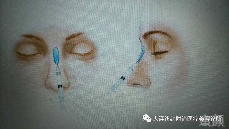 https://img.miyanlife.com/mnt/timg/170825/14330S033-1.jpg