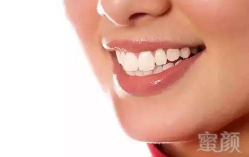 https://img.miyanlife.com/mnt/timg/170829/111Z2E11-1.jpg