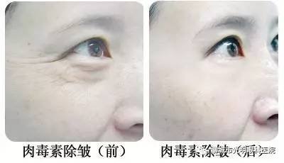 https://img.miyanlife.com/mnt/timg/170829/1134015619-0.jpg