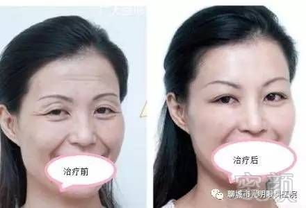 https://img.miyanlife.com/mnt/timg/170829/11340211S-1.jpg