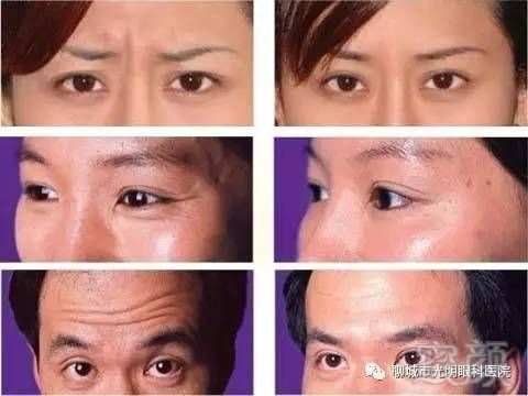 https://img.miyanlife.com/mnt/timg/170829/1134026122-2.jpg